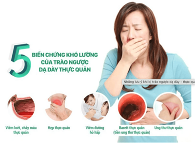 6 nguyên nhân gây trào ngược dạ dày thực quản mà bạn nên cảnh giác