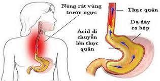 Nguyên nhân gây viêm xung huyết hang vị dạ dày